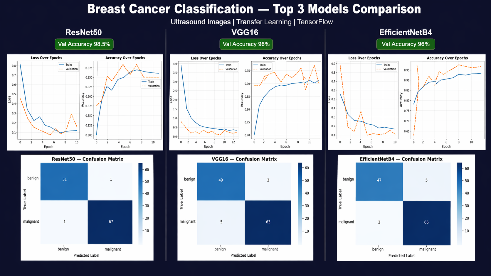 Breast Cancer Classification Transfer Learning