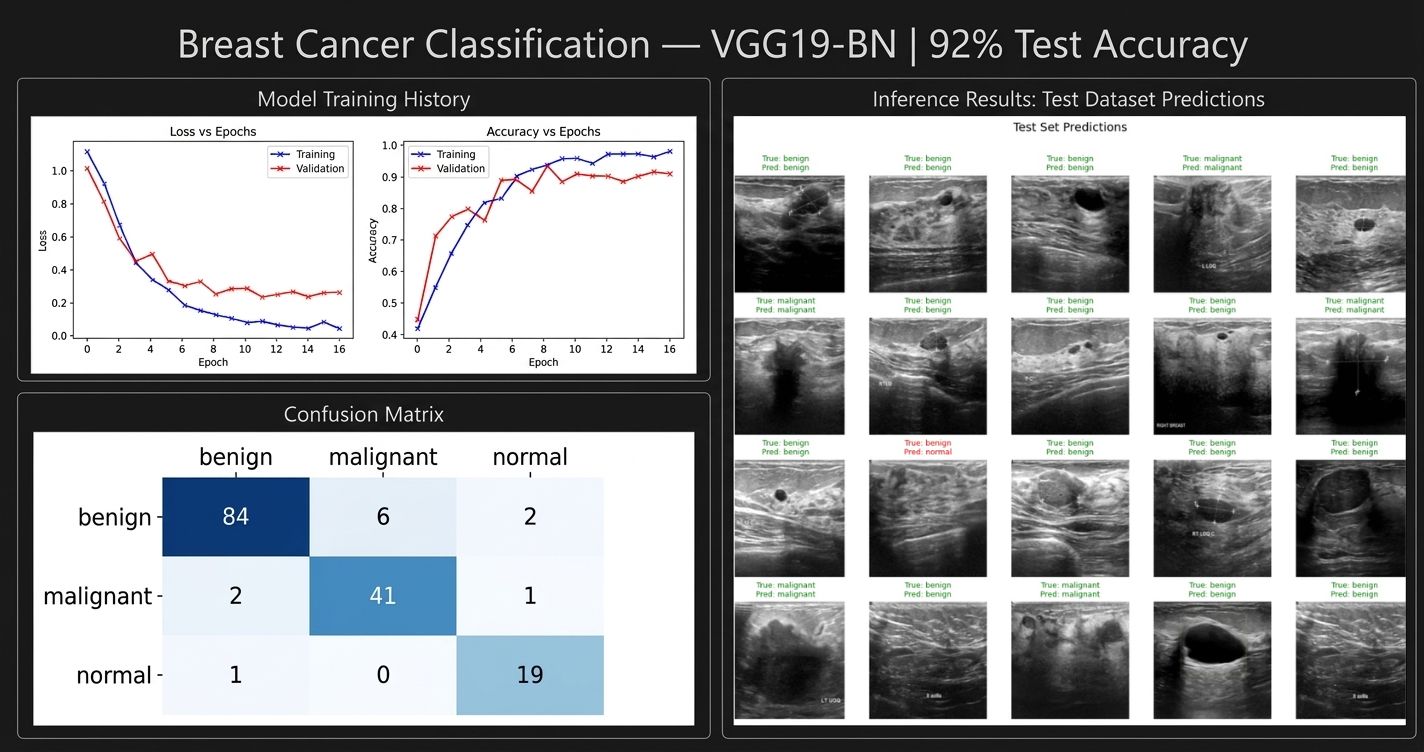 Breast Cancer Classification